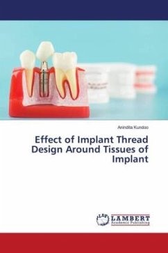 Effect of Implant Thread Design Around Tissues of Implant