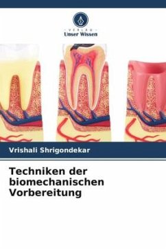 Techniken der biomechanischen Vorbereitung - Shrigondekar, Vrishali;Gulve, Meenal