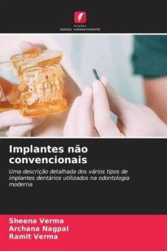 Implantes não convencionais - Verma, Sheena;Nagpal, Archana;verma, Ramit