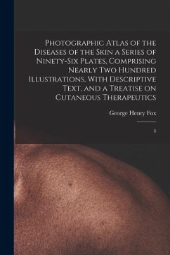 Photographic Atlas of the Diseases of the Skin a Series of Ninety-six Plates, Comprising Nearly two Hundred Illustrations, With Descriptive Text, and - Fox, George Henry