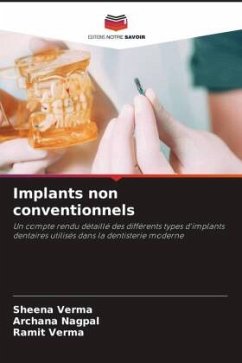 Implants non conventionnels - Verma, Sheena;Nagpal, Archana;verma, Ramit