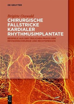 Chirurgische Fallstricke kardialer Rhythmusimplantate (eBook, PDF) - Osswald, Brigitte