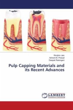 Pulp Capping Materials and its Recent Advances - Jain, Rimjhim;B. Prasad, Ashwini;Raisingani, Deepak