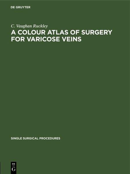 A Colour Atlas of Surgery for Varicose Veins (eBook, PDF) A Colour Atlas of Surgery for Varicose Veins (eBook, PDF)