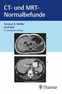 CT und MRT Normalbefunde (eBook, PDF) - Möller, Torsten Bert; Reif, Emil