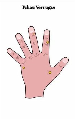 Cover Tchau Verrugas (eBook, ePUB)