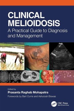 Cover Clinical Melioidosis