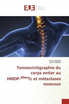 Tomoscintigraphie du corps entier au HMDP-99mTc et métastases osseuses - HAMZA, Fatma;JARDAK, Issam