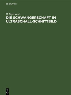 Die Schwangerschaft im Ultraschall-Schnittbild (eBook, PDF) - Bayer, H.; Schulte, R.; Prenzlau, P.; Lüder, R.