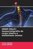 HMDP-99mTc tomoscintigrafia de corpo inteiro e metástases ósseas