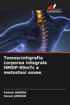 Tomoscintigrafia corporea integrale HMDP-99mTc e metastasi ossee - HAMZA, Fatma;JARDAK, Issam