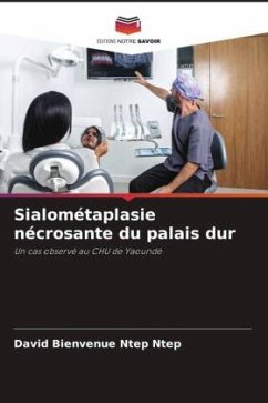 Cover Sialométaplasie nécrosante du palais dur