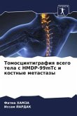 Tomoscintigrafiq wsego tela s HMDP-99mTc i kostnye metastazy