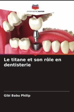Le titane et son rôle en dentisterie - Philip, Gibi Babu