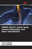 HMDP-99mTc whole body tomoscintigraphy and bone metastases