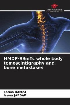 HMDP-99mTc whole body tomoscintigraphy and bone metastases - HAMZA, Fatma;JARDAK, Issam