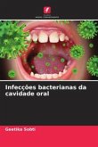 Infecções bacterianas da cavidade oral