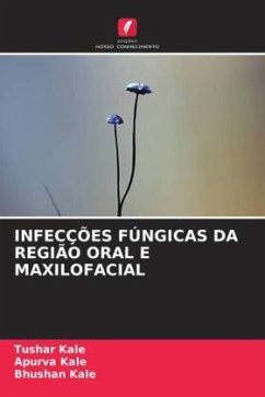 Cover INFECÇÕES FÚNGICAS DA REGIÃO ORAL E MAXILOFACIAL