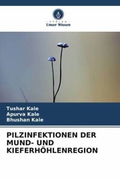 PILZINFEKTIONEN DER MUND- UND KIEFERHÖHLENREGION - Kale, Tushar;Kale, Apurva;Kale, Bhushan