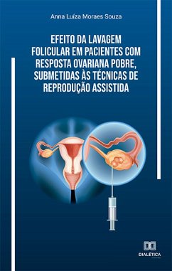 Efeito da lavagem folicular em pacientes com resposta ovariana pobre, submetidas às técnicas de reprodução assistida (eBook, ePUB) - Souza, Anna Luíza Moraes