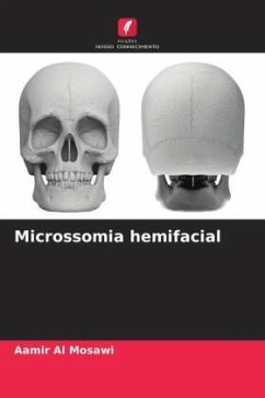 Cover Microssomia hemifacial