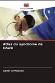 Atlas du syndrome de Down