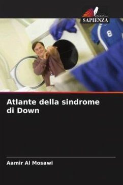 Atlante della sindrome di Down - Al Mosawi, Aamir