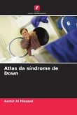 Atlas da síndrome de Down