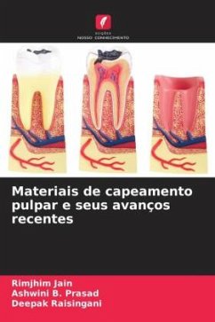 Materiais de capeamento pulpar e seus avanços recentes - Jain, Rimjhim;B. Prasad, Ashwini;Raisingani, Deepak