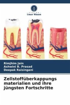 Zellstoffüberkappungs materialien und ihre jüngsten Fortschritte - Jain, Rimjhim;B. Prasad, Ashwini;Raisingani, Deepak