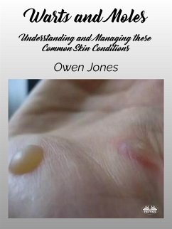 Warts And Moles (eBook, ePUB) - Jones, Owen