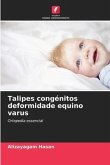 Talipes congénitos deformidade equino varus