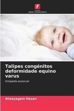 Talipes congénitos deformidade equino varus - Hasan, Alizayagam