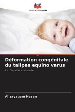 Déformation congénitale du talipes equino varus - Hasan, Alizayagam