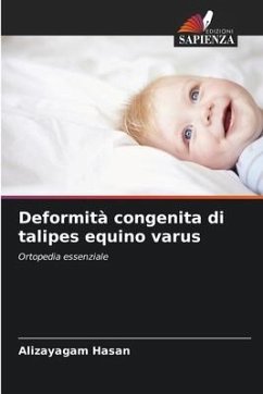 Deformità congenita di talipes equino varus - Hasan, Alizayagam