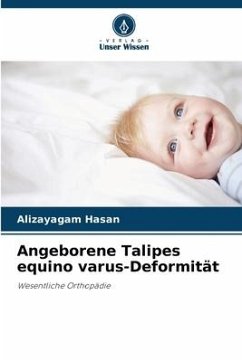 Angeborene Talipes equino varus-Deformität - Hasan, Alizayagam