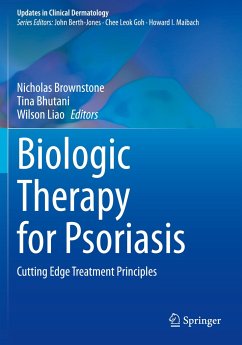 Biologic Therapy for Psoriasis