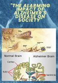 "The Alarming Impact of Alzheimer's Disease on Society" (eBook, ePUB)