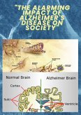 "The Alarming Impact of Alzheimer's Disease on Society" (eBook, ePUB) "The Alarming Impact of Alzheimer's Disease on Society" (eBook, ePUB)
