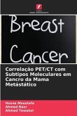 Correlação PET/CT com Subtipos Moleculares em Cancro da Mama Metástático