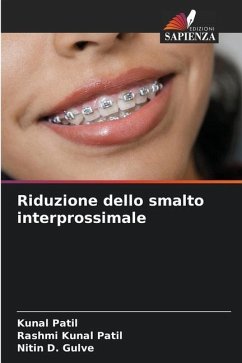 Riduzione dello smalto interprossimale - Patil, Kunal