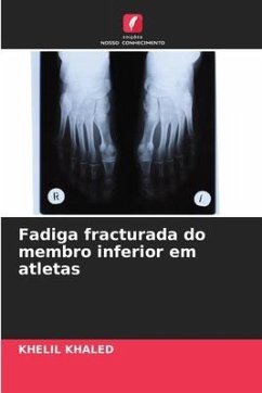 Fadiga fracturada do membro inferior em atletas - Khaled, Khelil