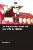 Les empreintes dans les implants dentaires