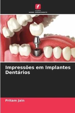 Impressões em Implantes Dentários - Jain, Pritam