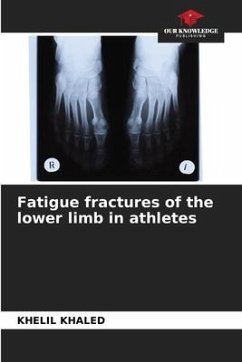 Fatigue fractures of the lower limb in athletes - Khaled, Khelil