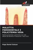 MALATTIA PARODONTALE E POLICITEMIA VERA