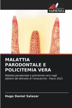 MALATTIA PARODONTALE E POLICITEMIA VERA - Salazar, Hugo Daniel