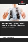 Pulmonary tuberculosis and thrombolic diseases