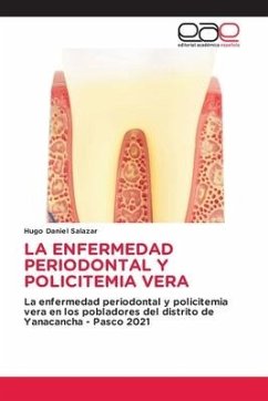 LA ENFERMEDAD PERIODONTAL Y POLICITEMIA VERA - Salazar, Hugo Daniel