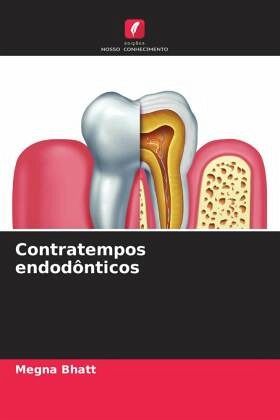 Contratempos endodônticos